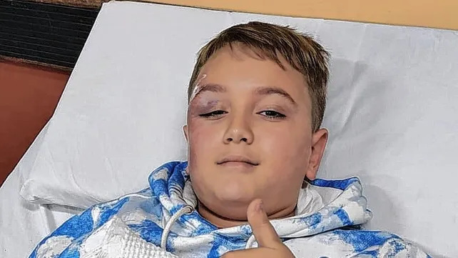 El chico de 11 años fue embestido por un auto mientras andaba en bicicleta junto a su padre en la ciclovía de Vélez Sarsfield y Alem.
